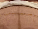 詩(shī)麗莎硅酮疤痕凝膠修護兒童成人創(chuàng  )傷燒燙剖腹產(chǎn)增生凸起手術(shù) ５支【買(mǎi)3送同款2支】深層淡疤-專(zhuān)注老疤舊疤 曬單實(shí)拍圖
