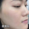 Newliann醫(yī)用重組人表皮生長因子噴霧外用修復(fù)皮膚屏障凝膠原蛋白補(bǔ)水保濕 曬單實(shí)拍圖
