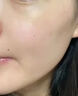 維a酸乳膏去老年斑專用藥祛斑專用藥老年斑專用藥一夜i消去斑去黑色素的藥臉部手背皮膚用藥 非處方藥 1盒【點斑祛斑專用藥】 曬單實拍圖
