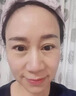 阿琪思豐盈面部太陽(yáng)穴下巴淚溝眼窩額頭填充凹陷修復神器去法令精華液 曬單實(shí)拍圖