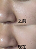 仁和元?dú)廛蜍甙苏渥阗N足部護(hù)理艾灸艾葉艾草腳底睡眠穴位貼暖腳暖足貼 30貼*3盒 【超值裝-縱享生活】 曬單實(shí)拍圖
