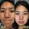 貝玲美美白水乳保濕補水護膚品套裝乳液保濕水精華水爽膚水提亮抗皺緊致 377美白精華水乳面霜3件套 曬單實(shí)拍圖