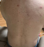 北京同仁堂后背痘痘藥膏后背長(zhǎng)痘痘毛囊炎專用前胸后背部膿包痤瘡祛痘噴霧劑 買2送1【發(fā)3盒】發(fā)貨特效快 曬單實(shí)拍圖