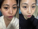 OHBT黃芪面膜10片抗皺緊致抗衰老補水熬夜亮白淡斑女男士金榜第1名 曬單實(shí)拍圖