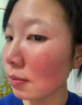 Newliann醫用重組膠原蛋白修復敷料乳液人表皮生長(cháng)因子凝膠皮膚屏障面霜 曬單實(shí)拍圖