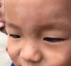 北京協(xié)和醫(yī)院爐甘石抑菌止癢膏皮膚瘙癢身體癢止癢100%藥皮濕炎疹真菌感染過敏 特效1盒【日本進口】 日本進口蚊子蚊蟲叮咬止癢王消腫 曬單實拍圖