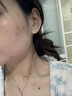 dyey點(diǎn)痣膏無(wú)痕去痣黑痣瘊子點(diǎn)痣液扁平尤絲狀尤尖尤肉刺肉兒童可用 曬單實(shí)拍圖