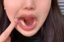 補(bǔ)牙洞材料自己補(bǔ)牙神器牙齒修復(fù)補(bǔ)牙縫蛀牙洞臨時(shí)門牙齒修復(fù)填充 1盒【補(bǔ)牙神器】能補(bǔ)10顆 曬單實(shí)拍圖