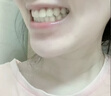 香港大藥房有限公司牙結(jié)石去口臭去黃去牙漬煙漬溶解液牙垢清除洗牙齒可搭牙膏非凡 曬單實拍圖