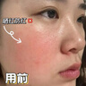 奈皙日本曬后修復急救皮膚屏障受損泛紅積雪草曬傷藥膏男士醫(yī)美用煥白 曬單實拍圖