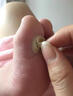 腳醫生雞眼貼雞眼膏成人去腳根足部肉刺腳趾老繭腳墊脫落 曬單實(shí)拍圖