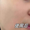 ZHENMI新加坡進(jìn)口377氨基酸洗面奶男女士控油祛痘去黑頭淡斑提亮膚色 曬單實(shí)拍圖