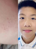 ORGINESE青少年洗面奶氨基酸12-18歲男女孩控油非祛痘黑頭學(xué)生專用潔面乳 曬單實(shí)拍圖