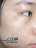 CLOUK氨基酸洗面奶男女士美白淡斑提亮膚色控油清潔毛孔祛痘黑頭潔面乳 【告別黃黑皮】美白潔面乳520ml*1 曬單實拍圖