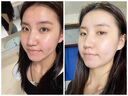 OHBT黃芪面膜10片抗皺緊致抗衰老補水熬夜亮白淡斑女男士金榜第1名 曬單實拍圖