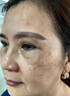 片仔癀皇后牌美白祛斑膏美白淡化黑色素老年黃褐雀斑曬斑祛斑霜護(hù)膚品女 美白祛斑膏1瓶【贈防曬霜】 曬單實拍圖