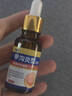 Newliann醫用甲溝炎消腫專(zhuān)用工具息肉紅腫去肉芽嵌甲發(fā)炎化膿膏矯正器制藥 曬單實(shí)拍圖
