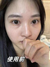 ZHENMI新加坡進(jìn)口眼膜貼眼袋提拉緊致抗皺淡化黑眼圈重度祛除眼袋男女士 曬單實(shí)拍圖