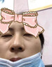 香港大藥房顆粒清肌滋潤眼霜脂肪粒去除藥膏專(zhuān)用去汗管瘤脂肪小顆粒淡化細紋 10盒【重度脂肪粒去除】鞏固裝 曬單實(shí)拍圖