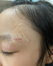 沃朗森醫(yī)用祛疤膏祛疤痕修復(fù)凝膠醫(yī)院專用去疤痕藥膏硅酮除疤膏手術(shù)縫針 曬單實(shí)拍圖