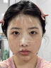 Treesymbol進(jìn)口除螨蟲(chóng)祛痘氨基酸洗面奶美白祛斑控油男女士去角質(zhì)黑頭潔面乳 【油敏肌首選】袪痘洗面奶100g 曬單實(shí)拍圖