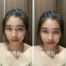 Redact澳洲抬頭紋川字紋貼去除神器額頭皺紋貼去除男女抗皺緊致衰老專用 曬單實拍圖