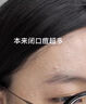 BVSYL德國高端醫用痘痘貼消炎吸膿隱形嫩膚去痘i印痤瘡痘坑痘i疤防護貼 醫用痘痘貼48貼【日夜雙效】 曬單實(shí)拍圖