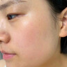 Newliann醫用重組膠原蛋白修復敷料乳液人表皮生長(cháng)因子凝膠皮膚屏障面霜 曬單實(shí)拍圖