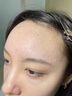 儒意水楊酸祛痘精華痘印修復(fù)淡化痘印控油收縮毛孔去黑色素沉淀護(hù)膚品 40ml 【1滴祛痘】輕度痘肌 紅腫膿痘 曬單實拍圖