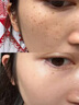 德傳公祛斑點(diǎn)斑專用水藥美白淡化老年黃褐雀斑黑斑男士去除黑色素沉淀霜 1盒裝【一抹祛斑】醫(yī)用級(jí) 曬單實(shí)拍圖