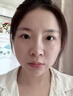 東洋之花玻尿酸原液精華液抗皺緊致精華提拉男女士衰老淡化細(xì)紋法令紋 曬單實(shí)拍圖