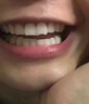 愛牙博士補(bǔ)牙齒神器材料永久自己在家補(bǔ)牙進(jìn)口納米樹脂高硬度牙洞i填充劑 （優(yōu)惠標(biāo)準(zhǔn)版）醫(yī)用正品 曬單實(shí)拍圖