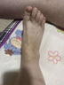 APGMA苗藥濕毒清軟膏頑固濕疹藥止癢去病根有濕毒皮膚瘙癢皮炎濕疹專(zhuān)用 特效3盒裝【買(mǎi)二送一】98%的選擇 曬單實(shí)拍圖