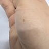 祥醫堂咪奎莫特乳膏5%醫用祛疣型京東大藥5%咪喹正品軟膏疣體脫落專(zhuān)用膏 1盒 曬單實(shí)拍圖