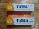 DAGO手足脫皮膏汗泡手上癢起小水泡手干脫皮腳癢專用疹膏季節(jié)性手脫皮 曬單實(shí)拍圖