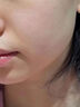 復方珍珠暗瘡片痤瘡專(zhuān)用藥女性去粉刺濕疹修復瘙癢面部紅斑丘疹性濕疹清熱解毒涼血消斑反復長(cháng)紅腫痤瘡痘痘 3盒裝【油脂堵塞粉刺膿皰】 曬單實(shí)拍圖