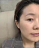 德韓德瑪韓雙美膠原蛋白水光玻尿酸自打除皺童顏針劑提升緊致凹陷 臺灣悅時(shí)塑雙美 正品防偽可查配套操作工具 曬單實(shí)拍圖