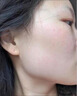 維A酸乳膏去疣體特新效期藥扁平疣專用藥去疣類藥膏去脖子小肉粒頸部瘊子去尤瘊小肉粒去疣膏瘊子肉刺肉粒 1盒裝【國藥準(zhǔn)字脫疣瘊】 瘊子去除國藥準(zhǔn)字藥膏  放心購買 安心售后 曬單實(shí)拍圖