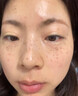 焦博士日本377祛斑霜美白淡化老年黃褐雀斑黑色素熊果苷乳膏去曬男女士 曬單實(shí)拍圖