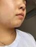 阿達(dá)帕林凝膠醫(yī)用祛痘消炎痤瘡專用青少年藥膏去痘痘和痘印閉合性粉刺藥膏臉上長痘痘治療重度青春痘硬疙瘩 1盒裝【粉刺膿包痘印】 曬單實(shí)拍圖