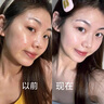 維特絲（vetes）去角質(zhì)面部啫喱控油保濕洗面奶男女士清潔毛孔黑頭閉口溫沒(méi)激素和 【6大專(zhuān)利】果酸去角質(zhì)啫喱200g 曬單實(shí)拍圖