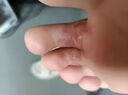 達克寧腳氣藥止癢脫皮爛腳丫真菌感染硝酸咪康唑乳膏治腳氣根專(zhuān)用特藥皮膚用藥 非處方藥腳臭腳趾縫瘙癢起水泡干裂 1盒【腳起水泡 癢的受不了】硝酸咪康唑乳膏 皮膚用藥 非處方藥達克寧腳氣藥止癢脫皮爛腳丫真菌 曬單實(shí)拍圖