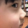 華美科醫用重組人體表皮生長(cháng)因子點(diǎn)痣疤痕修復凝膠燙軟膏傷口愈合15g1支 曬單實(shí)拍圖
