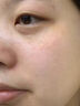 焦博士日本377祛斑霜美白淡化老年黃褐雀斑黑色素熊果苷乳膏去曬男女士 曬單實(shí)拍圖
