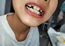 奧樂V6-12歲潔白系列小孩學(xué)生兒童護(hù)牙劑 換牙期蟲牙牙黃黑斑 兒童牙膏 【專業(yè)潔白】50克1支裝，送4件禮 曬單實(shí)拍圖