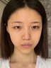 維特絲（vetes）去角質(zhì)面部啫喱控油保濕洗面奶男女士清潔毛孔黑頭閉口溫沒(méi)激素和 【6大專(zhuān)利】果酸去角質(zhì)啫喱200g 曬單實(shí)拍圖