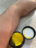 淞町制藥雞皮膚去除神器去雞皮膚毛囊角質(zhì)疙瘩大腿角化癥專(zhuān)用膏雞皮膚疙瘩 曬單實(shí)拍圖