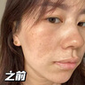 曼逖377氨基酸洗面奶500g男女士美白淡斑提亮膚色控油抗痘黑頭潔面乳 曬單實(shí)拍圖