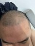 蔓迪生發(fā)噴霧米諾地爾酊90ml瓶5%濃度男女性防脫育發(fā)液藥洗發(fā)水發(fā)際線生長(zhǎng)快速生發(fā)增發(fā)凝膠搽劑曼迪 曬單實(shí)拍圖