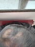 Tinstar云鬢生發(fā)膠囊密發(fā)科技內服固發(fā)護發(fā)防脫發(fā)修護靶向毛囊生物素養發(fā) 四瓶周期裝【中度發(fā)量失衡推薦/買(mǎi)3贈1】 曬單實(shí)拍圖